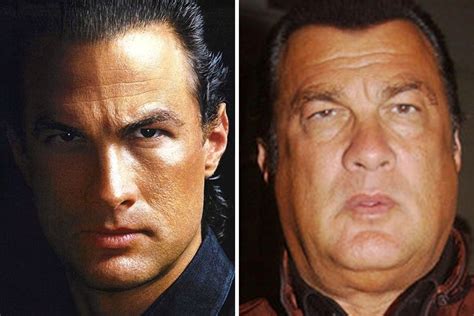 Steven Seagal Hair Before And After