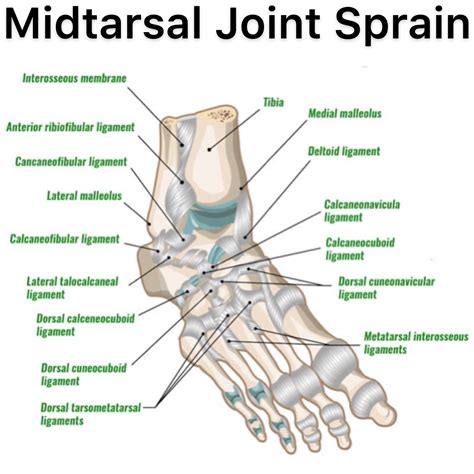 Tarsometatarsal Joint Ligaments