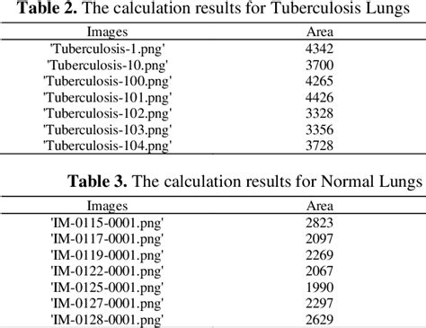 Table 3 From Clustering Of Tuberculosis And Normal Lungs Based On Image