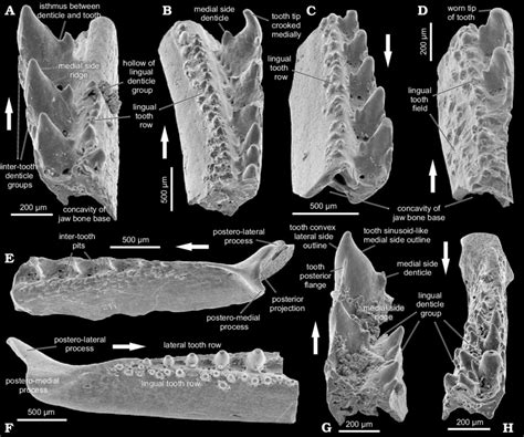 Early Devonian Acanthodians Podoliacanthus Zychi Sp Nov Af H And
