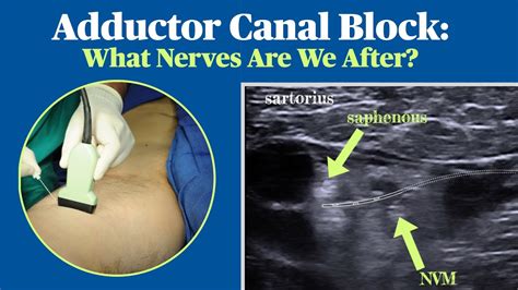 Adductor Canal Block What Nerves Are We After Youtube
