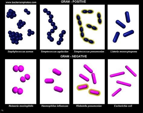 Gram Negative Bacteria Examples Gram Negative Anaerobic Bacteria