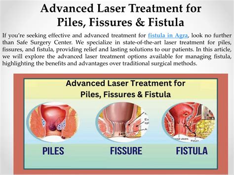 Ppt Fistulas Heaps And Gaps Are Treated Using Cutting Edge Lasers