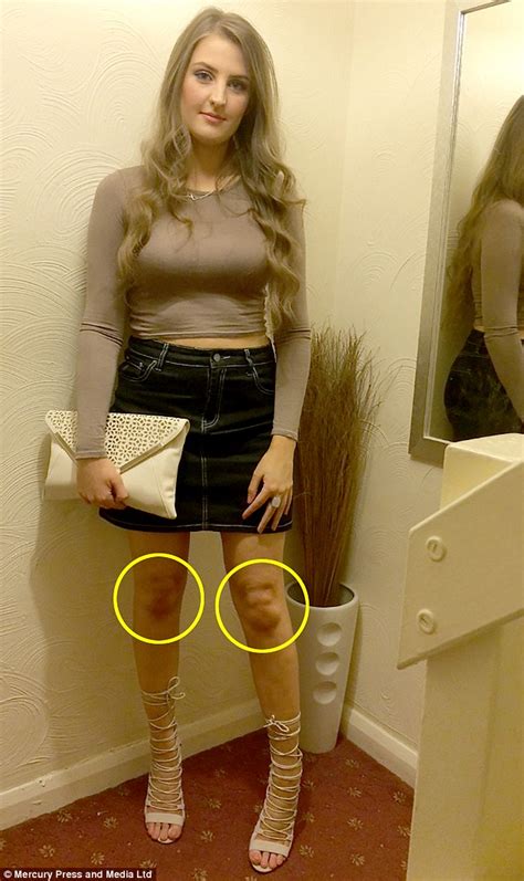 This Woman Claims Her Left Knee Looks Like James Corden Can You See It The Poke