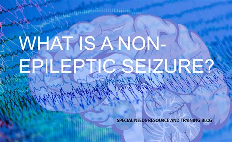 What Is A Non Epileptic Seizure Seizures Non Epileptic Seizures Epilepsy Awareness Month