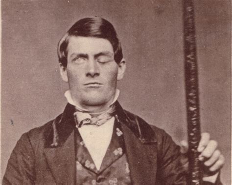 Phineas Gage Biography Brain Injury And Influence