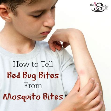 Mosquito Bites Vs Bed Bug Bites How To Tell The Difference Bed Bugs