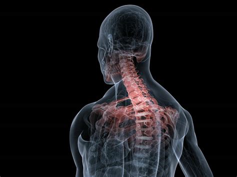 Cervical Spine Cervical Spine Injury Causes