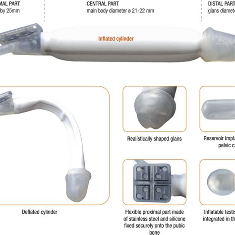 Zephyr Zsi Ftm Inflatable Penile Implant Used With Permission From Download Scientific