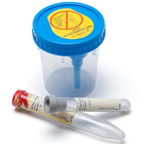 Vacutainer Urine Collection System
