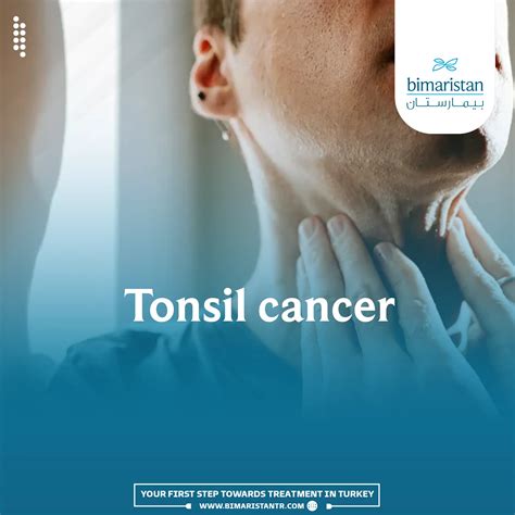 Malignant Tonsil Cancer Symptoms And Treatment In Türkiye Bimaristan
