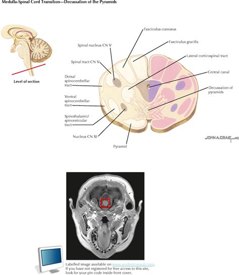 Brain Stem And Cerebellum Neupsy Key