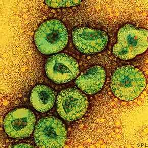 2019 novel coronavirus, wuhan seafood market pneumonia virus) — оболочечный одноцепочный. Severe Acute Respiratory Syndrome: A Fatal Contagious ...