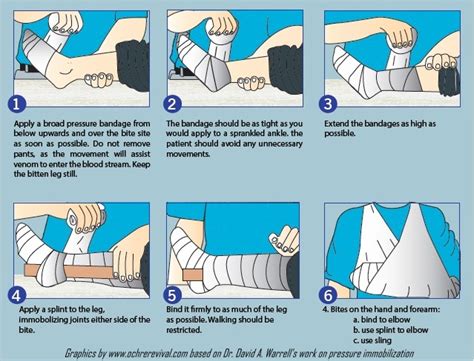 How To Apply A Compression Bandage For Snake Bite Snake Poin