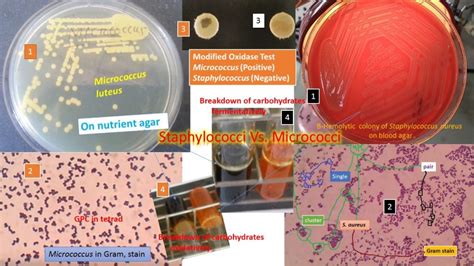 Staphylococcus Versus Micrococcus On The Basis Of Following Features