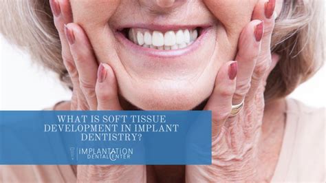Soft Tissue Development Dental Implant Dentistry