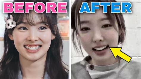 Twice Nayeon Trimmed Down Her Iconic Bunny Teeth Youtube