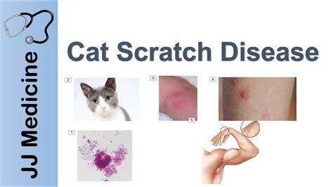 How Long Does It Take A Cat Scratch To Heal Cat Lovster