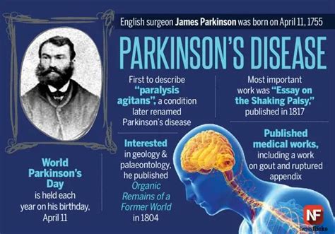 Shaking Disease Not Parkinsons Cogwheeling In Parkinsons Disease