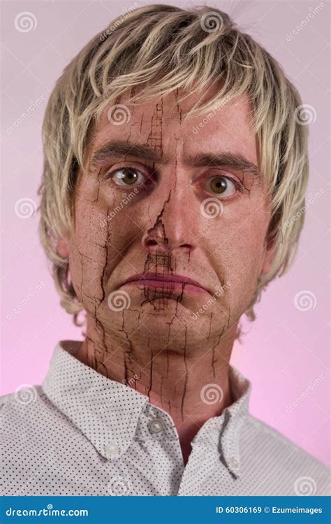 Man Dry Skin Stock Image Image Of Male Textured Moisturizer 60306169