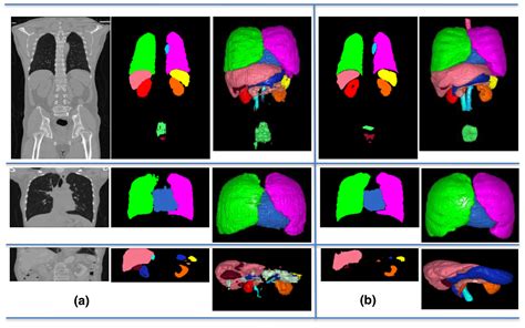 Deep Learning Of The Sectional Appearances Of 3d Ct Images For