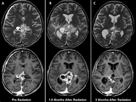Start studying mri t1 and t2. Axial MRI images (T2 weighted image in top row, T1 ...