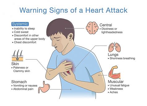 Coronary Heart Disease And Angina Symptoms PELAJARAN