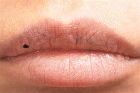 Don T Ignore These 10 Health Warning Signs Your Lips Are Telling You