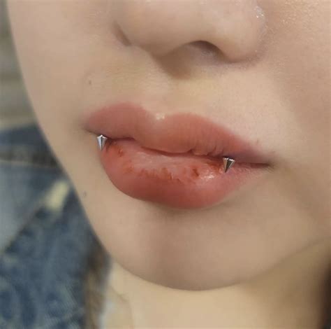 Reverse Vertical Labret Piercing Angel Bites In Lip Piercing