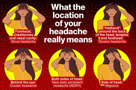 Why Do You Have A Certain Type Of Headache Location Is Key