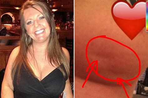 Lisa Royle Facebook Breast Picture Goes Viral Days Before Brave Mother