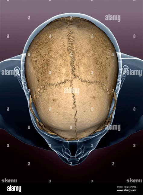 Skull Sutures 3d Computed Tomography Ct Scan Of The Surface Of A