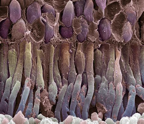 Retina Rod Cells Sem Photograph By Steve Gschmeissner Pixels