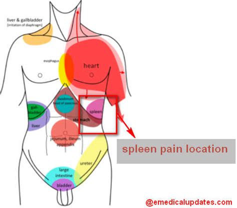 Spleen Pain Location Function Enlarged And Ruptured Spleen