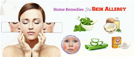 20 Effective Home Remedies For Skin Allergy In Children And Adults