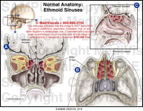 Normal Anatomy Ethmoid Sinuses Medical Exhibit