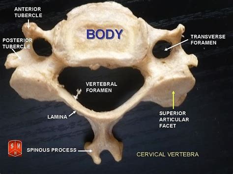 Cervical Vertebrae Of Horse Cervical Vertebrae Vertebrae Axial Skeleton
