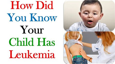 Signs And Symptoms Of Leukemia Cancer In Children Cancer Knowledge