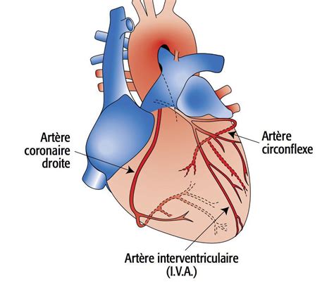 Chirurgie Cardiaque Marseillefr