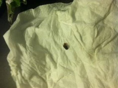 Bed Bug Found In Room Picture Of Holiday Inn Express Roseville