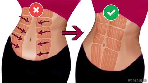 Fix Your Tummy Easy Diastasis Recti Workout Youtube