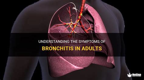 Understanding The Symptoms Of Bronchitis In Adults Medshun