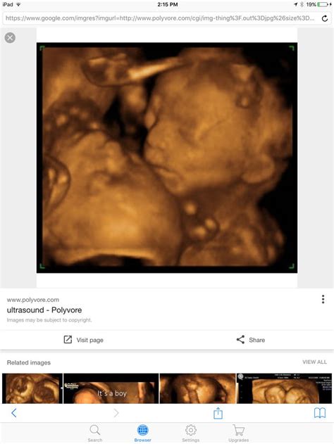 Maybe you would like to learn more about one of these? The same picture from a website of 3D-4D ultrasounds ...