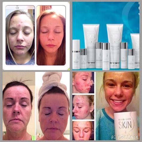• can be used on lips • if the client has extremely oily skin, line. New Skin Care Products from Herbalife - Pictures show real ...