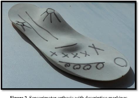 Figure 1 From Using The Edinburgh Visual Gait Score To Compare Ankle