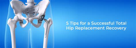5 Tips For A Successful Total Hip Replacement Recovery Cmri Kolkata