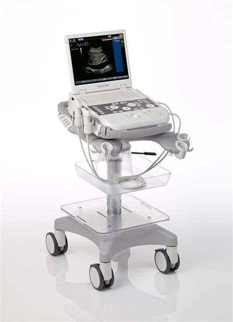 Siemens Introduces Acuson P300 Compact Portable Ultrasound System