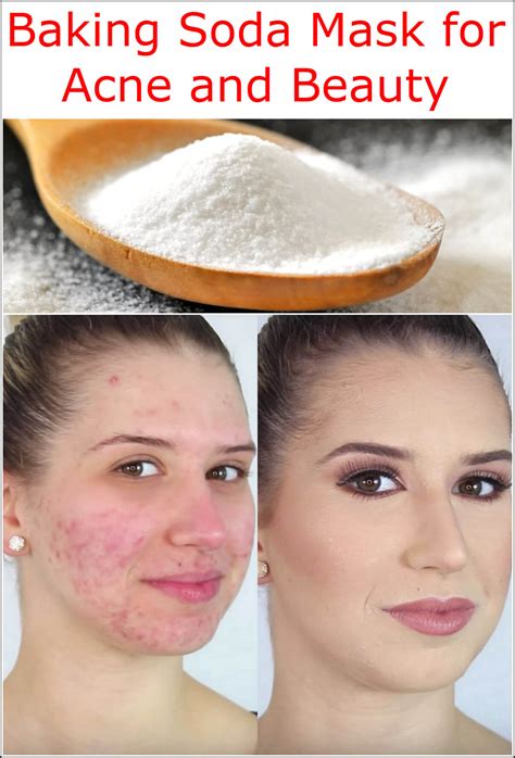 Baking Soda Mask For Acne And Beauty Baking Soda Uses And Diy Home