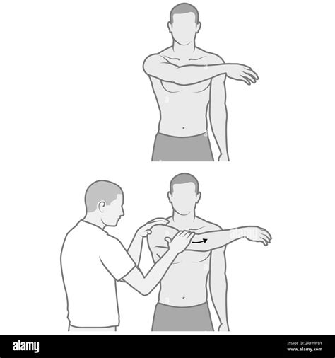 The external rotation test is a clinical examination technique used by
