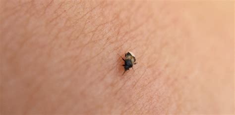 Little Black Bugs That Bite Identification Habitat And Behavior Pest